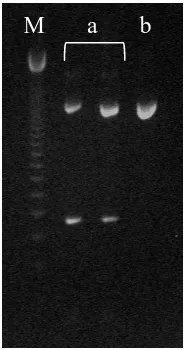 Figure 6- Gel electrophoresis showing amplification results between methods. a) JETQUICK Blood DNA Spin Kit (Genomed); b) isoamilic positions 12012-13828 using blood samples extracted with different phenol-chloroform