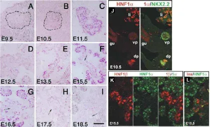 Figura 4.Figura 4. Patrón de expresión de  Patrón de expresión de HNF1HNF1�� durante el desarrollo de páncreas de ratón