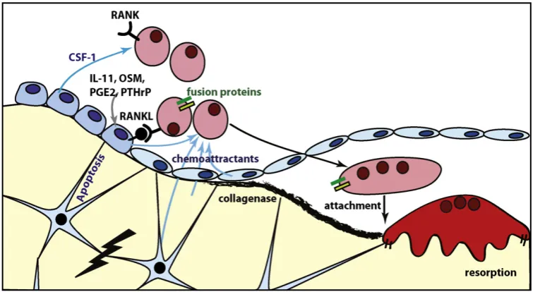 Figure 8. Osteoclast recruitment in the event of a microfracture (marked with the black lightening)