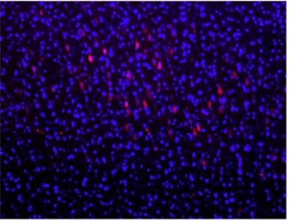 Figure   6:   Picture   of   pyramidal   neurons   expressing   the   mCherry   fluorescence   in   the   secondary   visual   cortex