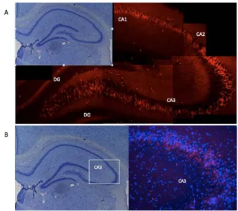 Figure    7:    The    mCherry    expression    in    the       NeuroD6    rat    brain
