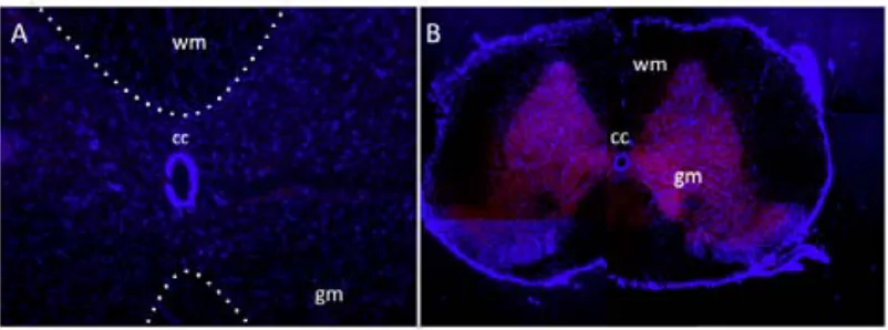 Figure   10:   Picture   showing   the   expression   of   the   mCherry   in   the   spinal   cord