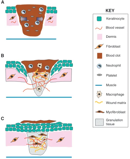 Figure 4: Schematic representation of different stages of wound repairvoir of growth factors required during the later stages ofthe healing process