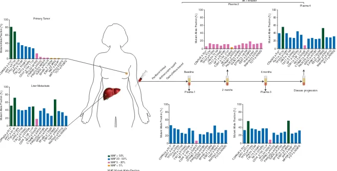 Figure 1. Patient disease presentation, treatment timeline and mutant alleles in the primary breast tumor, liver metastasis and plasma-derived DNA