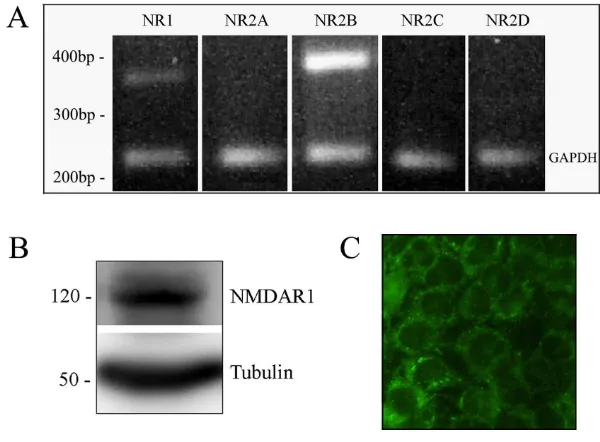 Figure 16. Expression of NMDA receptor subunits in HK-2 cells.expression of NMDAR1 protein (120 kDa) in HK-2 cells