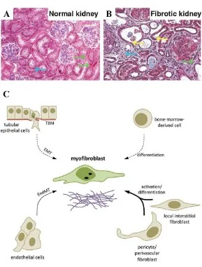 Figure 5. Origin of fibroblasts during kidney fibrosis. (A) Normal kidney with 