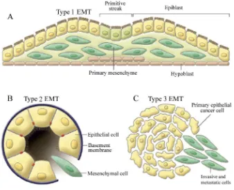 Figure 6. Different subtypes of epithelial-mesenchymal transition. (A) Type 1 EMT 