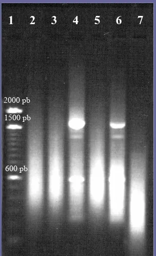 Figura 3.3. Productes de DOP-PCR de cèl.lules aïllades (1) Patró de bandes de 100 parells de bases