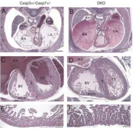 Figura 15: Desenvolupament cardíac en embrions DKO. Hematoxilina-eosina de seccions transverses de 
