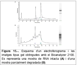 Figura 15.-. Esquema d’un electroferograma i les 