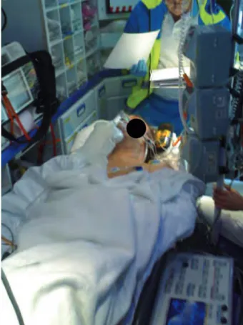 Figura 1. Fotografía del traslado de uno de los pacientes portadores de balón de contrapulsación intraaórtico.
