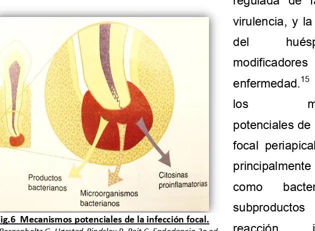 Fig.6  Mecanismos potenciales de la infección focal. 