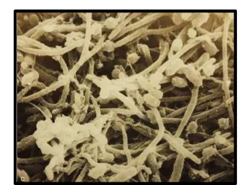 Fig.8 Infección densa en paredes de conducto 