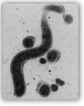 Fig.10 Treponema denticola. 