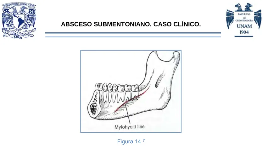 Figura 14 7 