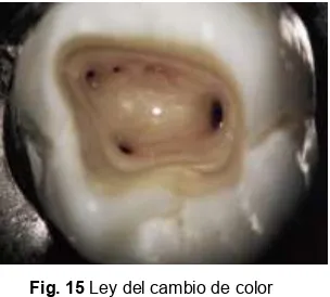 Fig. 15 Ley del cambio de color  (Fuente: Castellucci A. Access cavity and endodontic anatomy.) 
