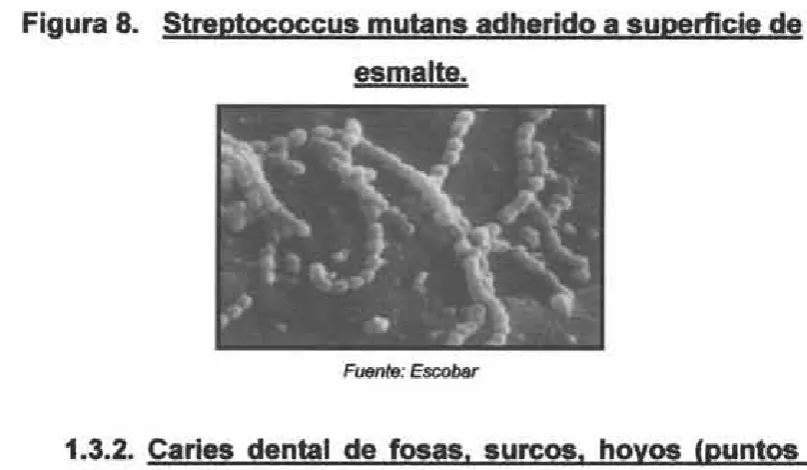 Figura 8. Streptococcus mutans adherido a superficie de