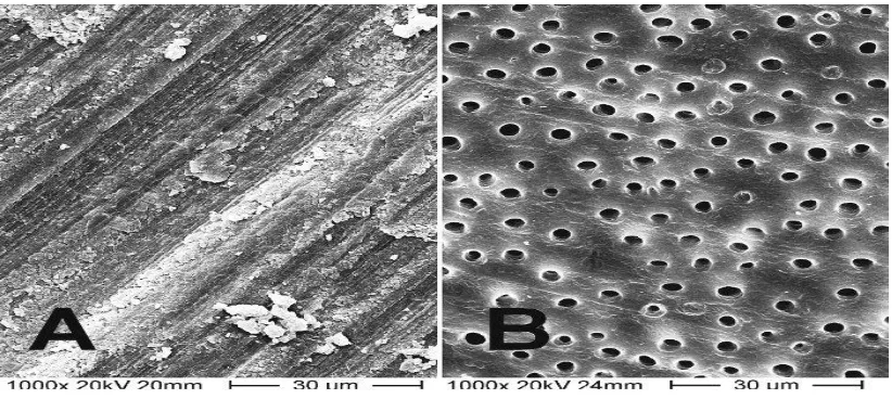 Fig. 8 Imagen obtenida mediante el microscopio electrónico de barrido de una capa 