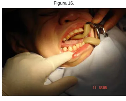 Figura 16. 