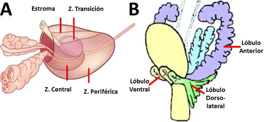 Figura 1. Anatomía prostática. A, Próstata humana. Se muestran las principales zonas de la glándula: estroma, transición, central y periférica