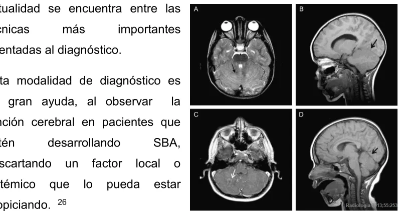 Figura  8. Resonancia Magnética Cerebral. 33