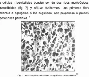 Fig. 7adenoma pleomorfo células mioepiteíiales plasrnocitoides 9