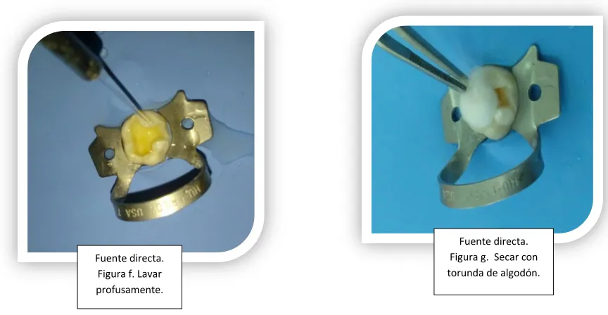 Figura g.  Secar con 