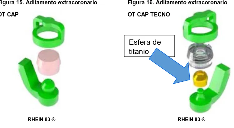 Figura 15. Aditamento extracoronario 