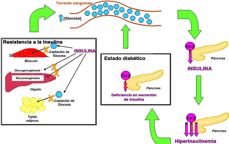 Figura 7. Desarrollo del estado diabético. Previo a la aparición de la diabetes tipo 2, la resistencia a la acción hipoglucémica de la insulina tiende a ocasionar un ligero aumento de la glucosa en sangre, lo cual estimula la secreción de insulina y causa 