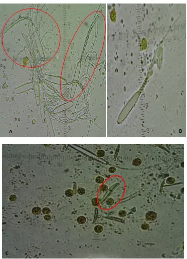 Fig. 11: Diferentes tipos de nematocistos identificados en Bartholomea annulata; (A), se puede observar una gran cantidad de nematocistos donde se observa un p-mastigóforo microbásico y un amastigóforo microbásico; (B), muestra un nematocisto p-mastigóforo