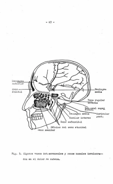 Fig. 3. Al eunos vasos intracraneales y senos nasales involucra--