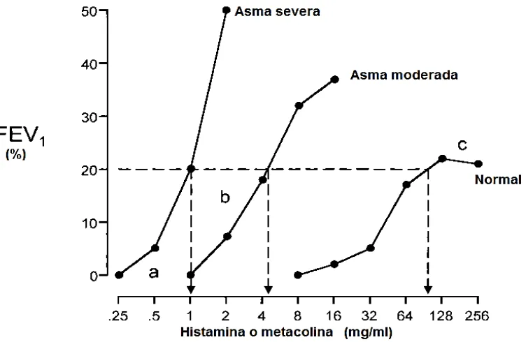 Figura 3. Curva de histamina ó metacolina. En individuos sanos la concentración necesaria para inducir una caída del 20% de la FEV1 es mayor en comparación a la necesaria para provocar el mismo efecto en un individuo con asma