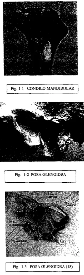 Fig. 1-1 CONDILO MANDIBULAR 
