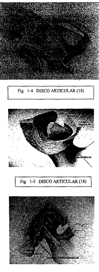 Fig. 1- 6 LrGAMENTOS (18) 