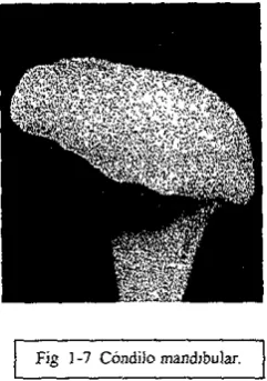 Fig J -7 Cóndilo mandlbular. 