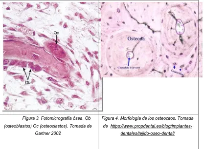 Figura 3. Fotomicrografía ósea. Ob 
