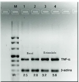 Figura 7: RT-PCR. Expresión basal e inducible con PMA de RNAm para TNF-a de monocitos control y en co-cultivo con la línea CALU-1