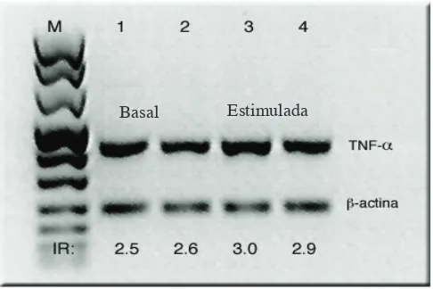 Figura 8: RT-PCR. Expresión basal e inducible con PMA de RNAm para TNF-a de monocitos control y en co-cultivo con la línea SK-LU-1