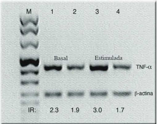 Figura 9: RT-PCR. Expresión basal e inducible con PMA de RNAm para TNF-a de monocitos control y en co-cultivo con la línea 3B1A