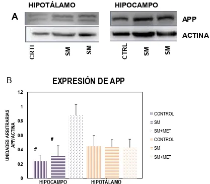 Figura 8. A) Imágenes representativas del Western Blot. B) Expresión de la proteína APP en hipocampo e hipotálamo como marcador de la neurodegeneración