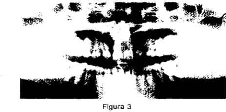 Figura 3 
