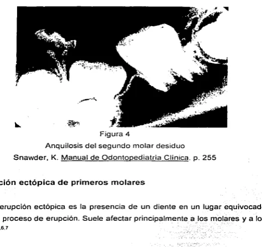 Figura 4 