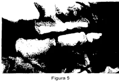Figura 5 