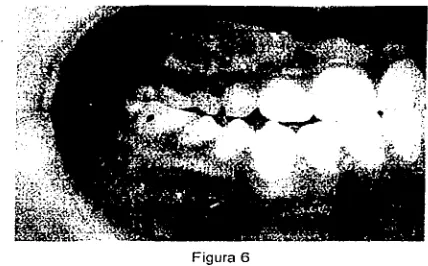 Figura 6 