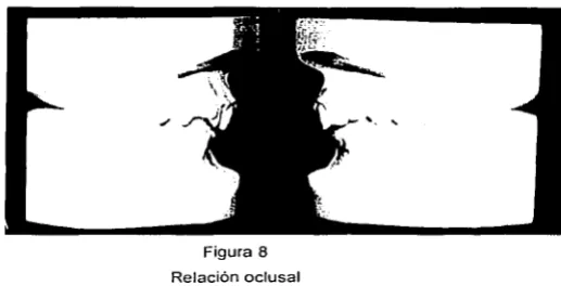 Figura 8 