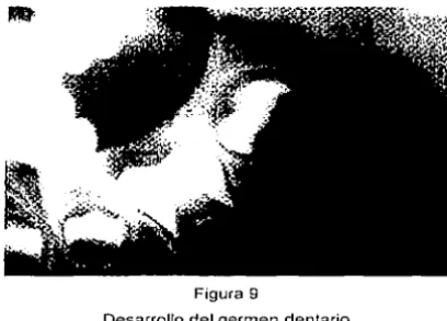 Figura 9 