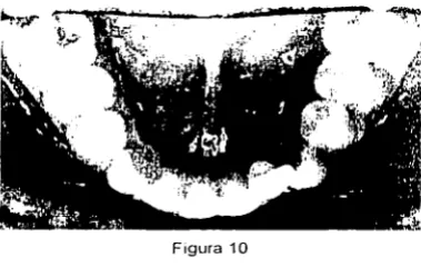 Figura 10 