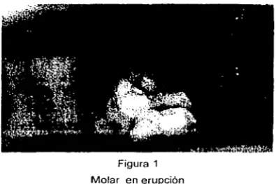 Figura 1 