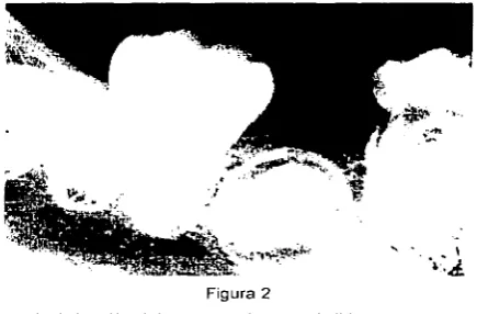 Figura 2 