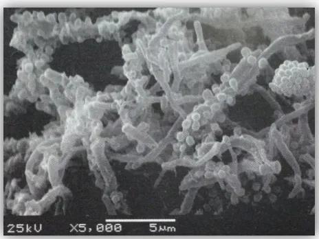 Fig. 5. MEB. Agregación y multiplicación bacteriana1. 